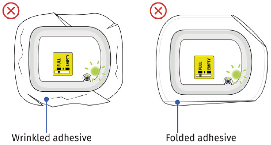 image 19 - UDENYCA ONBODY injector - OBI healthcare provider instructions for use