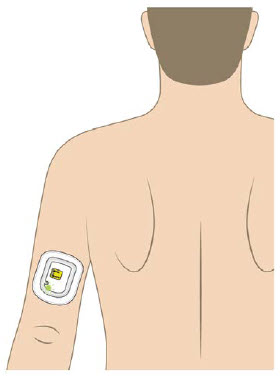 image 4 - UDENYCA ONBODY injector - OBI paitent instructions for use