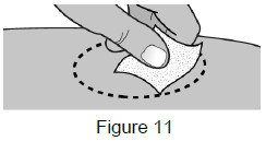 image of cleaning injection site - instructions for use