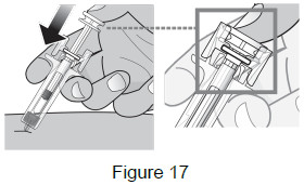 image of plunger push - instructions for use