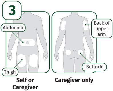 image of choosing injection site - AI instructions for use