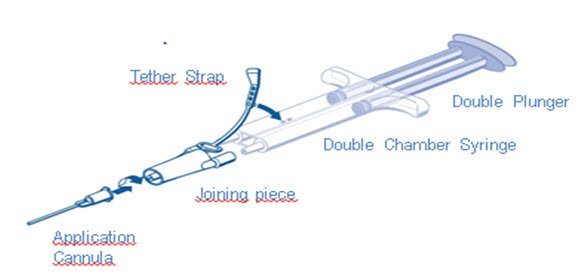 Figure 2 DUPLOJECT COMBI - PRIMA Syringe