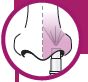 step_9_nose_image
