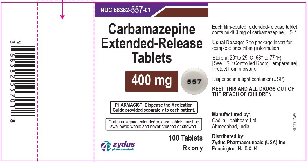 what are the side effects of carbamazepine er