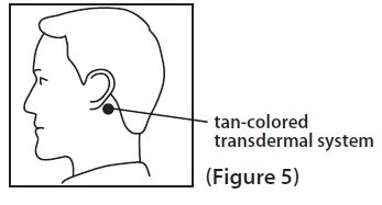 figure-5