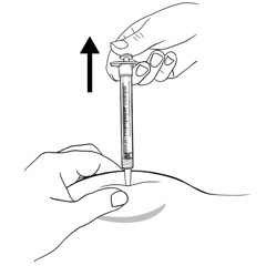IFU 2 Figure F