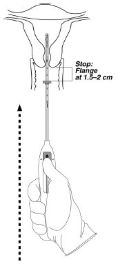 Advamcing insertion tube