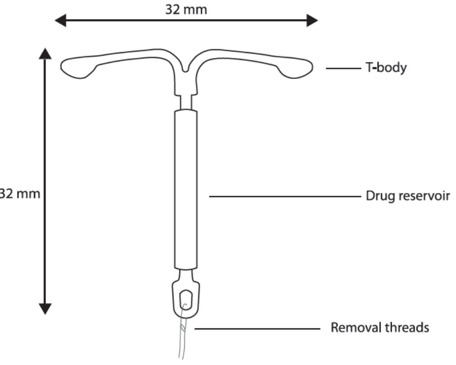 Mirena IUD