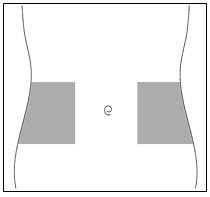 Figure E