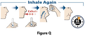 Figure Q - IFU