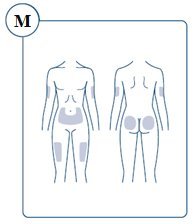Figure M injection sites