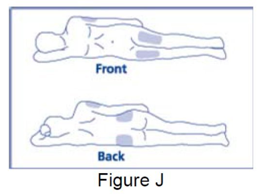 Injection site