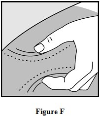 Instructions for Use Figure F