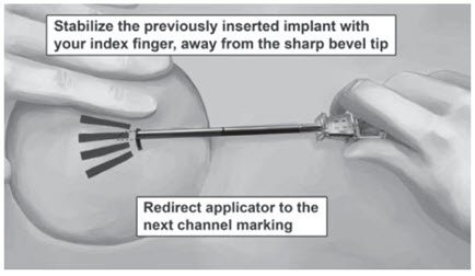 Figure 12