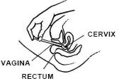 Can clindamycin be used for bladder infection?