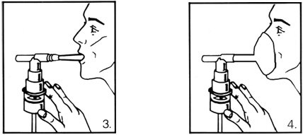 Figures 3 and 4