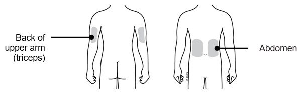 Neulasta: Package Insert - Drugs.com