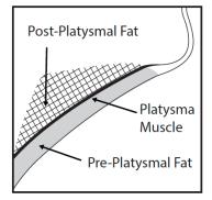 Figure 2. Sagittal View of Platysma Area