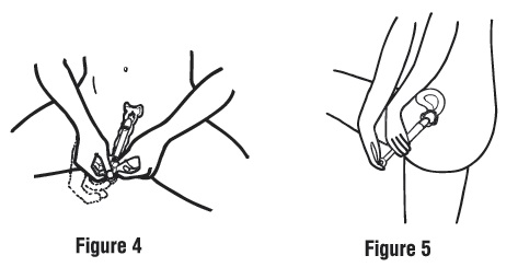 clindesse vaginal cream Suspensory ligament of the breast